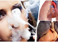 Bagaimana rokok meruksak paru-paru